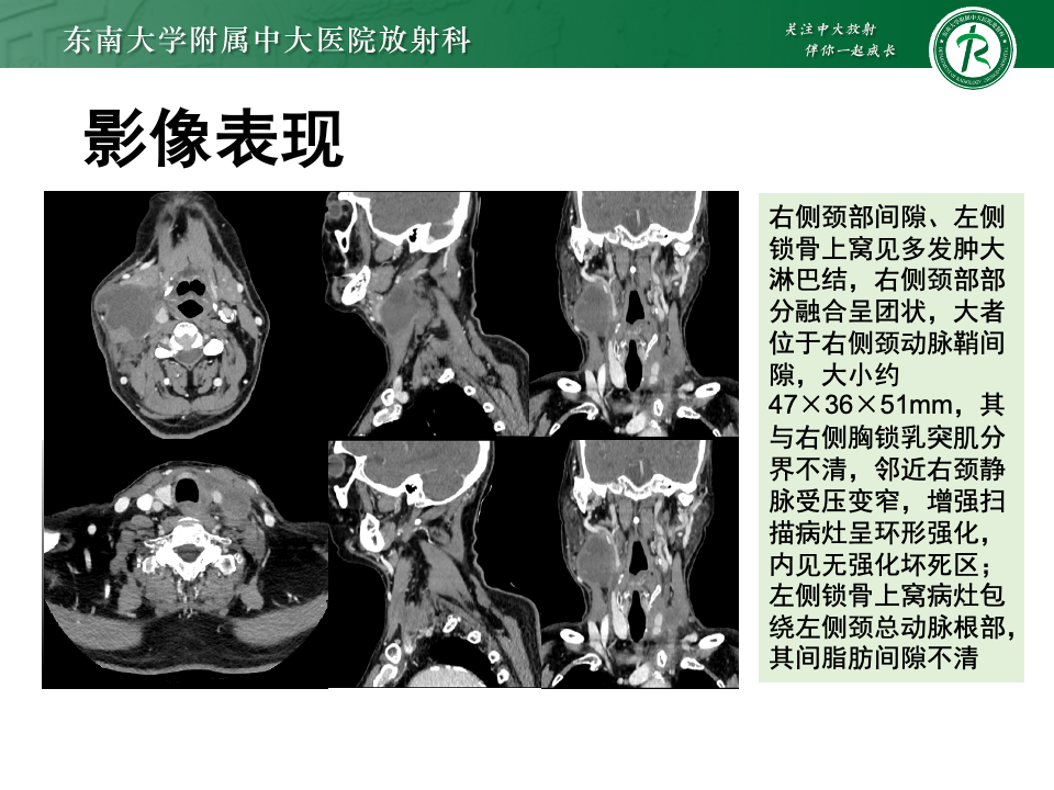 0edf7c55f7c91e04480f96217d710c71.png