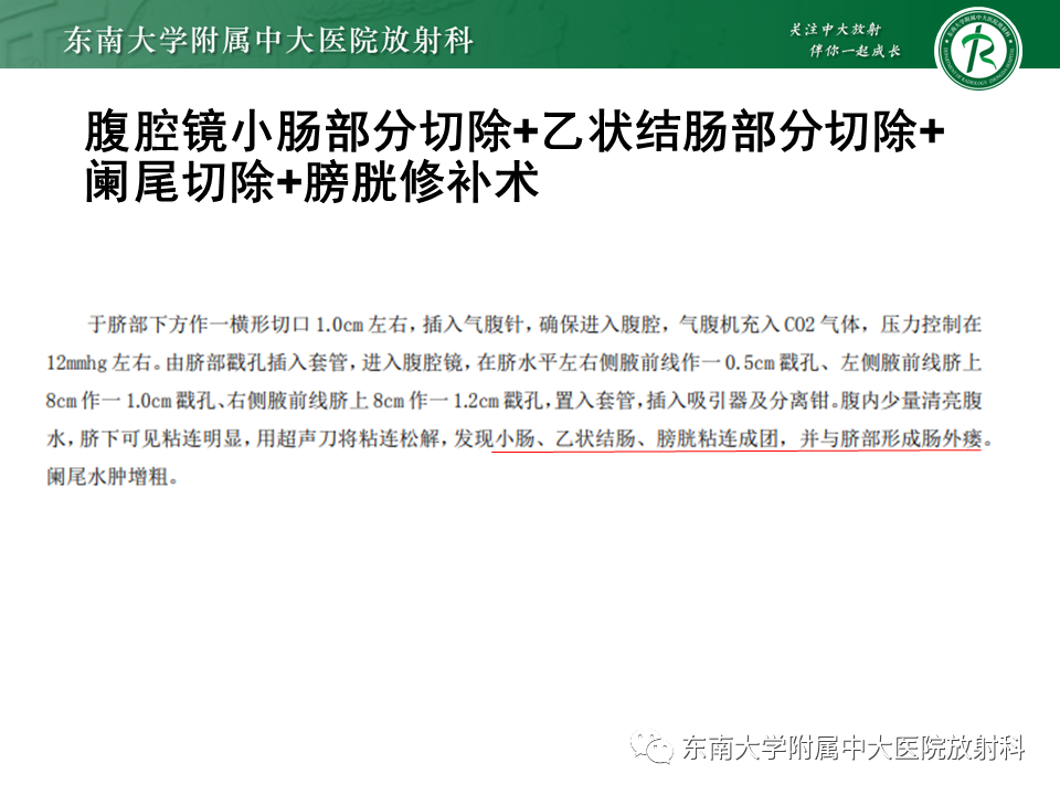 faf6ca78355f587f282f7ac85fc14b5c.png