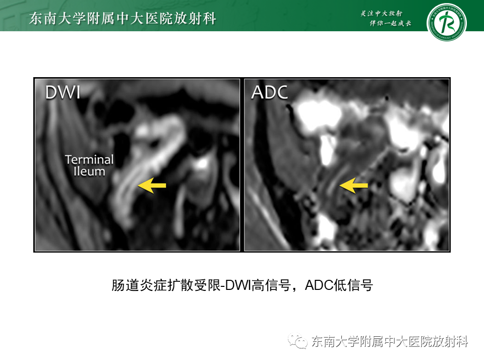 1c596262c65a14b1eebabd83c4827845.png