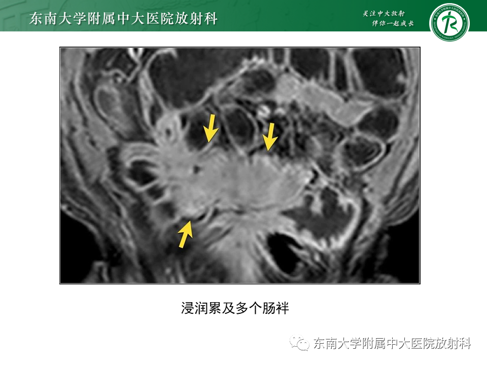 bfc2df5eb9545864a9085077b045ca44.png