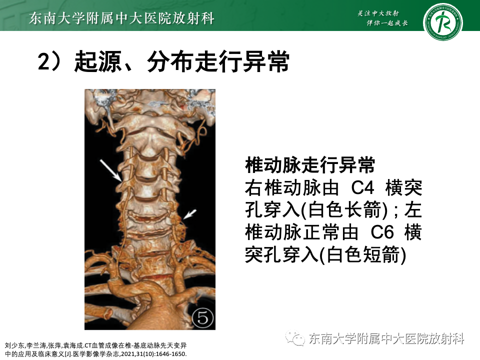 ff94ddcc5ebbb52dd1f13181cbd13618.png