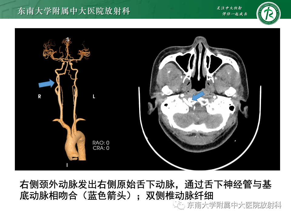 7b94bf9282d3d665dc0cb291989b7ccf.png