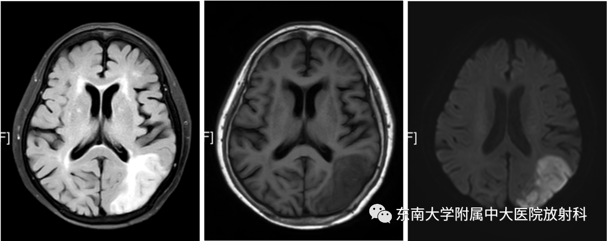 bd622c402bf2dd5061eab72411cc07d0.png