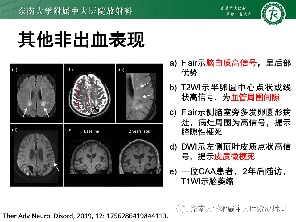 d52bc81429dba9cb1d40ee2ca69f9ef1.png