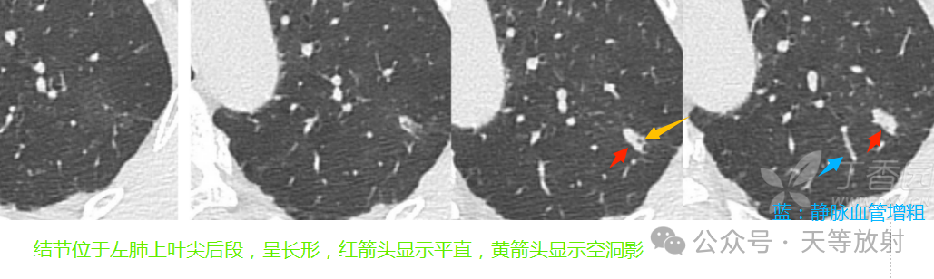 b1eeaf0331957b3c1ac126e78effa5ca.png