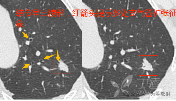 0cbd8319f9556a898832692212ecf435.png