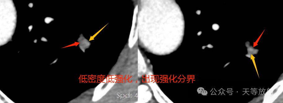 d7a613052d5e2d19f81b442c1995efab.png