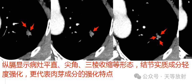 fe8f2024d2dd9fcd01adc33843a8f404.png