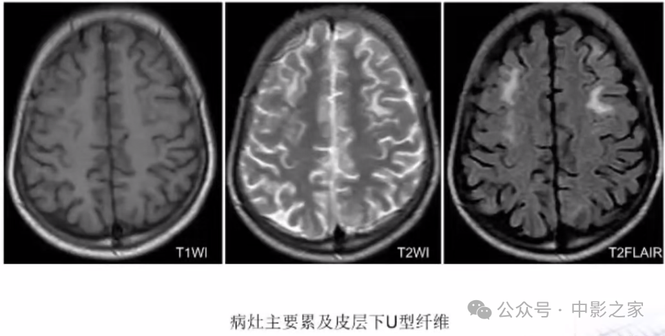 f76b384ba9dc839b1b9ed8e925bc346a.png