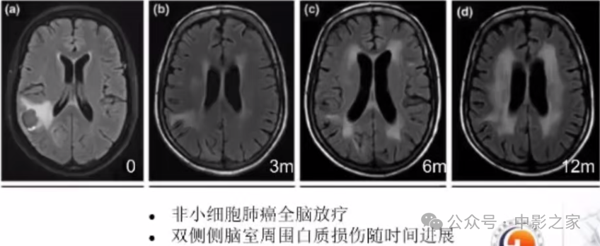 429ba42bf045bdaad471781c6d67c177.png