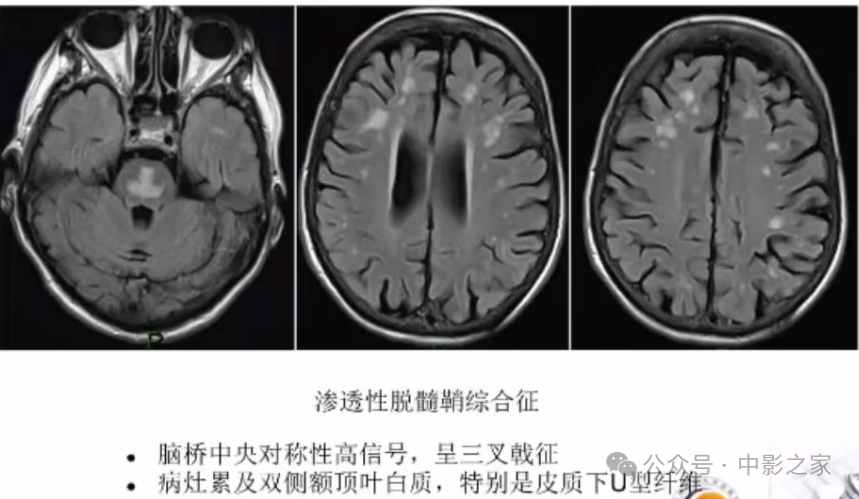 916aac79bfccb765665ed4d502206469.png