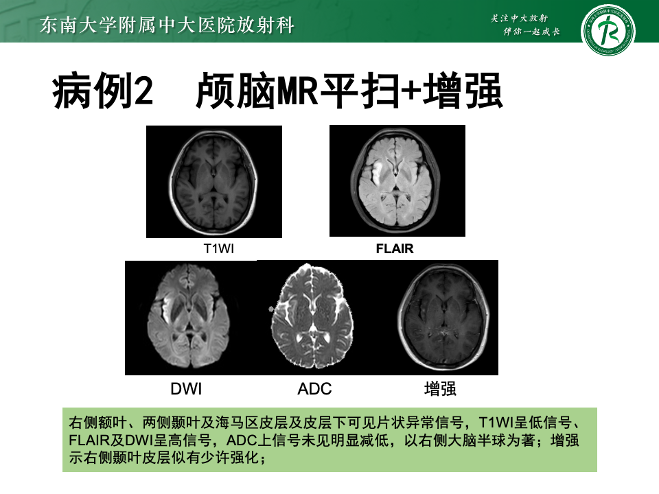 dd22a597b099e9dca14d8ee149199373.png