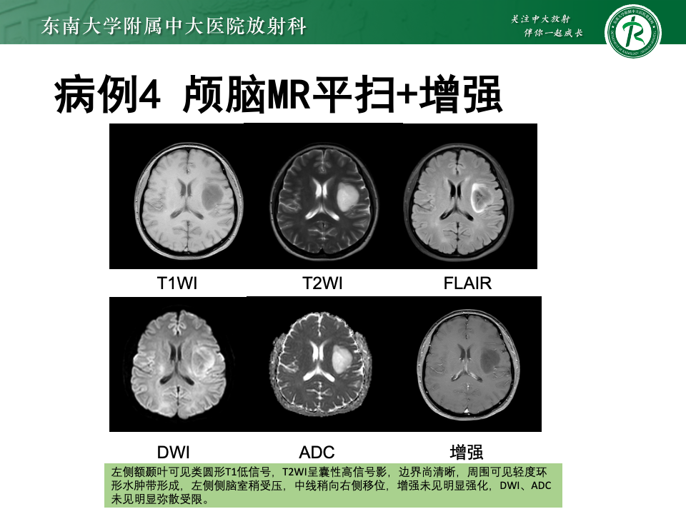 712cd71798e86f77acd7f48c06ff2a9d.png
