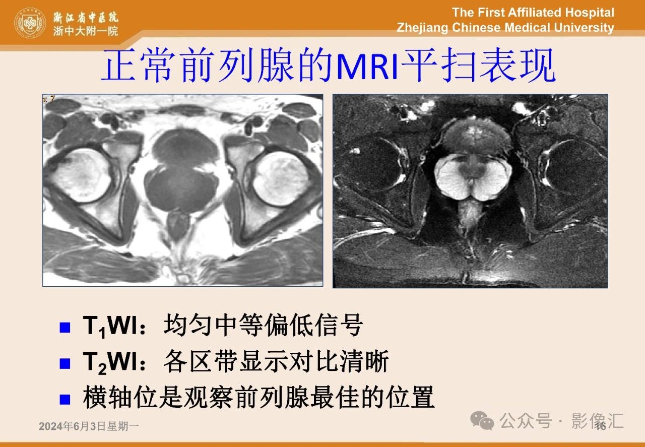 ce7ebcfa6030030e9007ed2426b8b88a.jpg