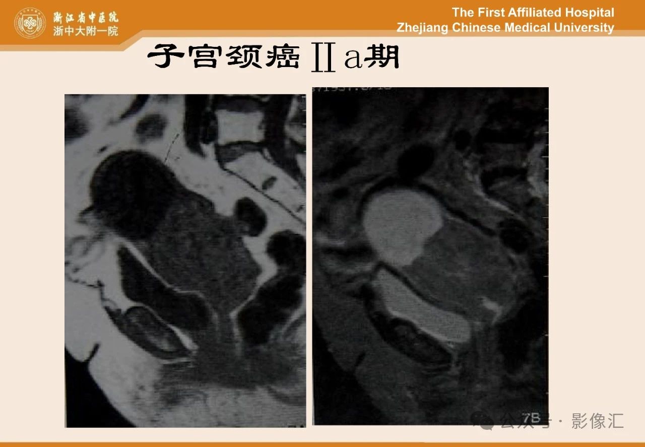 ca40213cca07de277da1bed2ed7e85bc.jpg