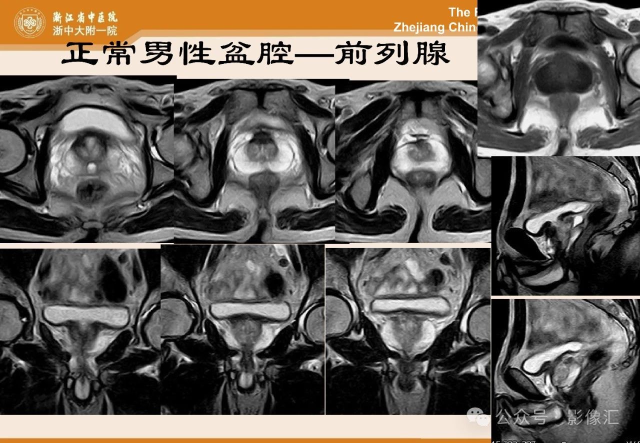 d56cb37e41818cd9c3688d825318f8b1.jpg