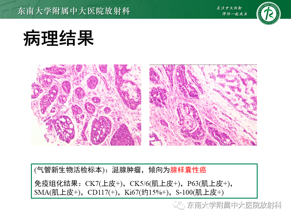eaf4c63de6f9ad39905c79d4d46f6fc3.png