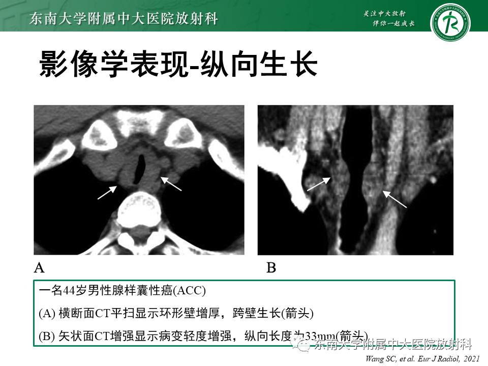 fb36f1bdbaedb194ebe806fbef3739ee.png