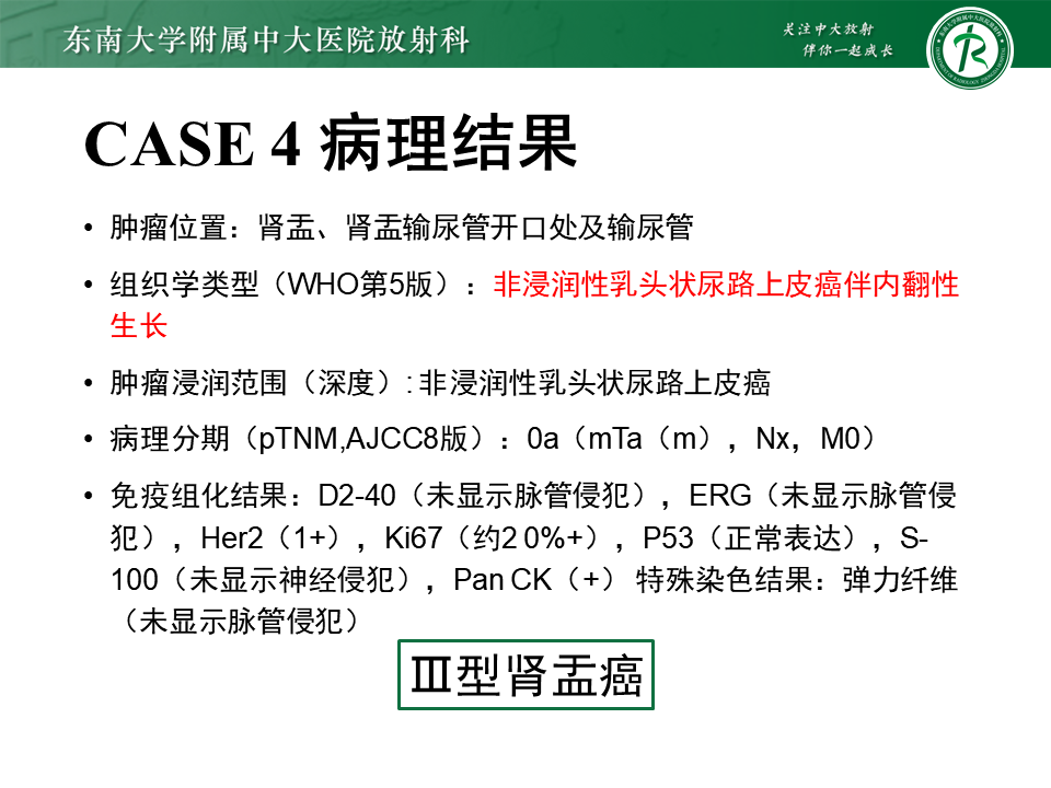 7bbc47dc2536d0591512b458ff8f589b.png