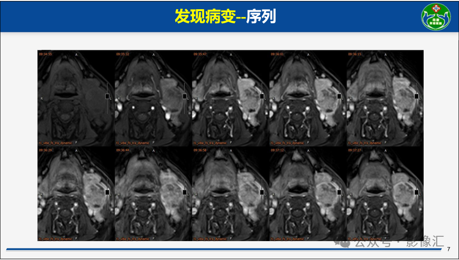 bfcb48615a5f8501636e43f195d29c41.png