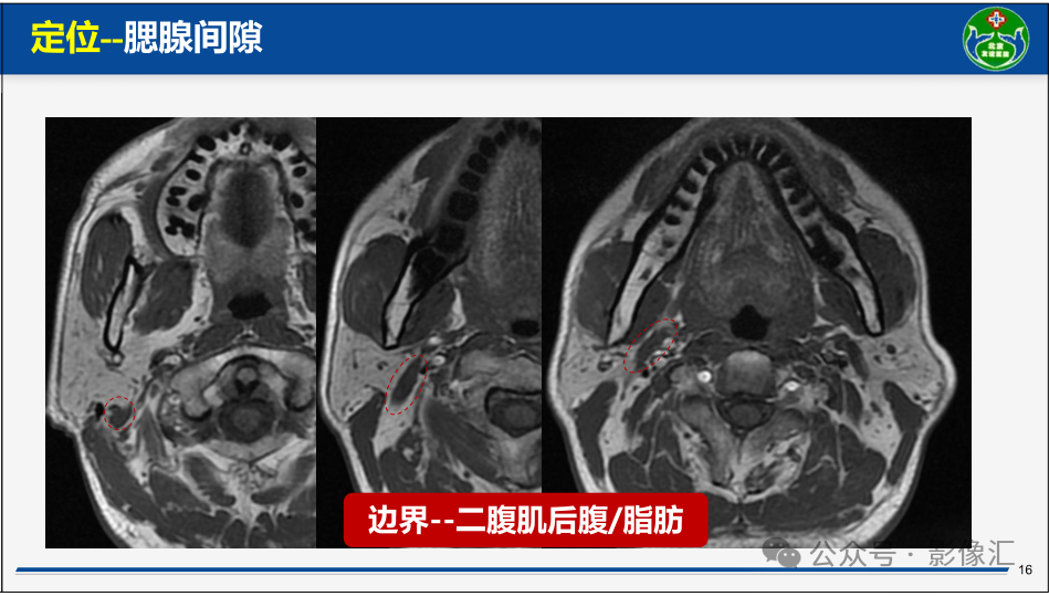 2f052a9964e12586ef41fa1ec8396c54.png