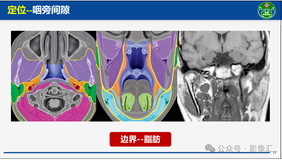 a387fc1c3c193b97ef56460bcac3d6c5.png