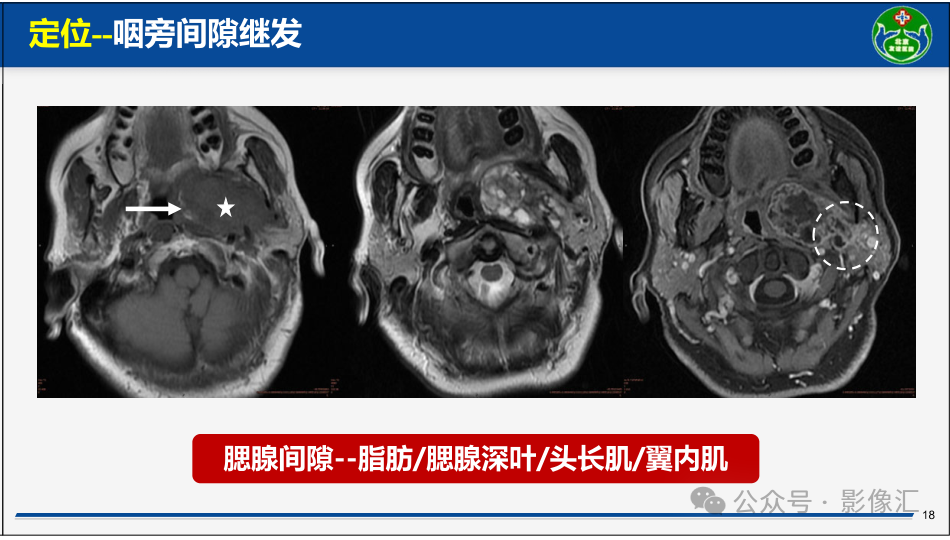 b1671ac9577f86a14fc607b8c714efdb.png