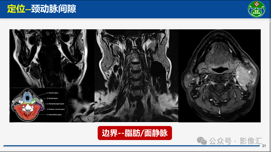 5009abe98cbae53017e9bff69d92c50d.png