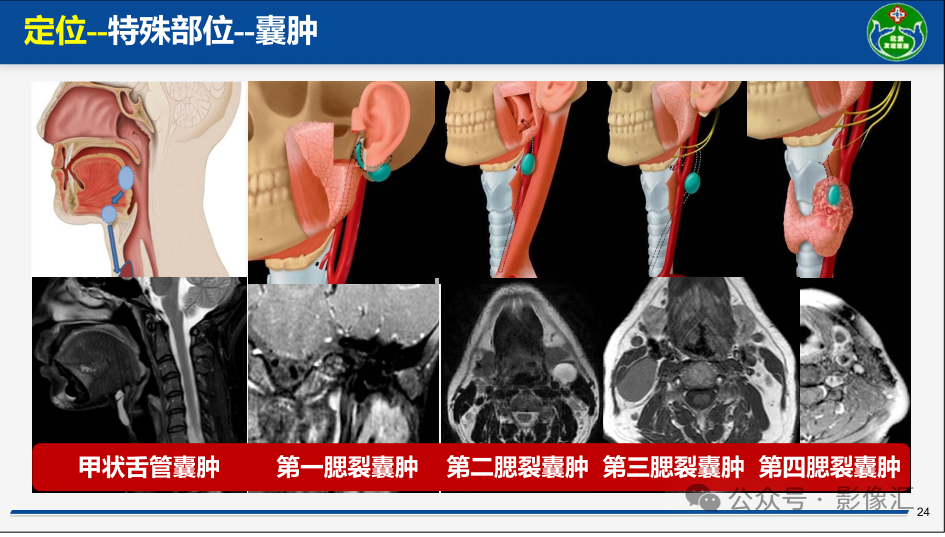 ebfc8696d93c358013d1c4cce05351a4.png