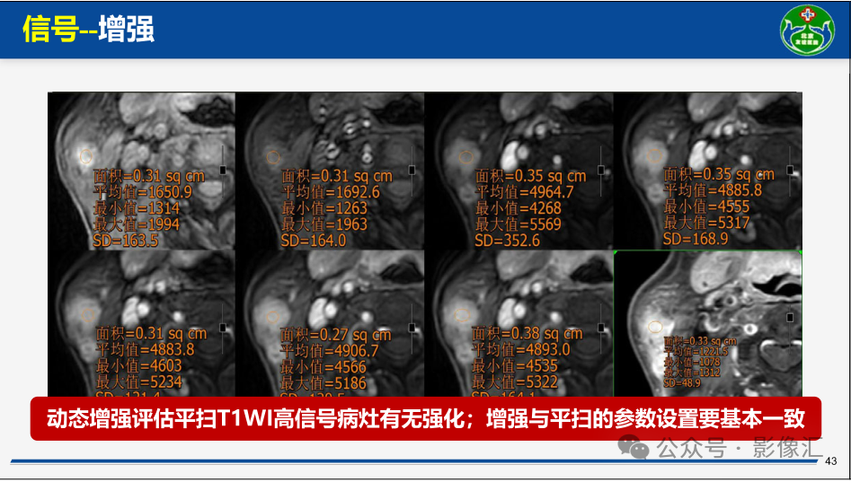 f106184b049148402a18511bad468839.png