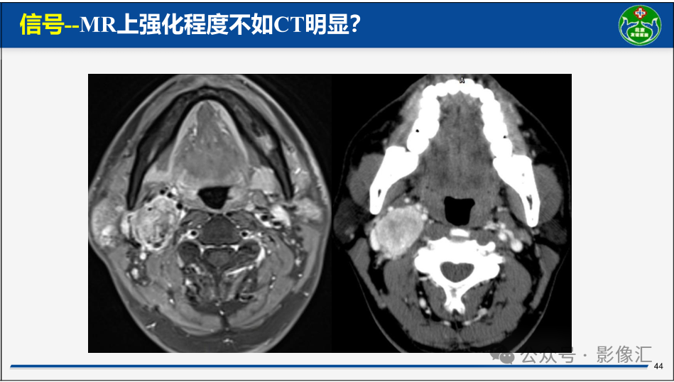 813e5e75daac8edfc0c141f7b57b9f56.png