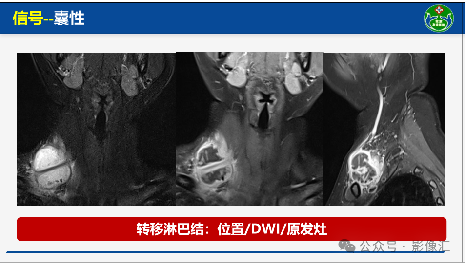 8d8f53b290170ec26747e7377a957472.png