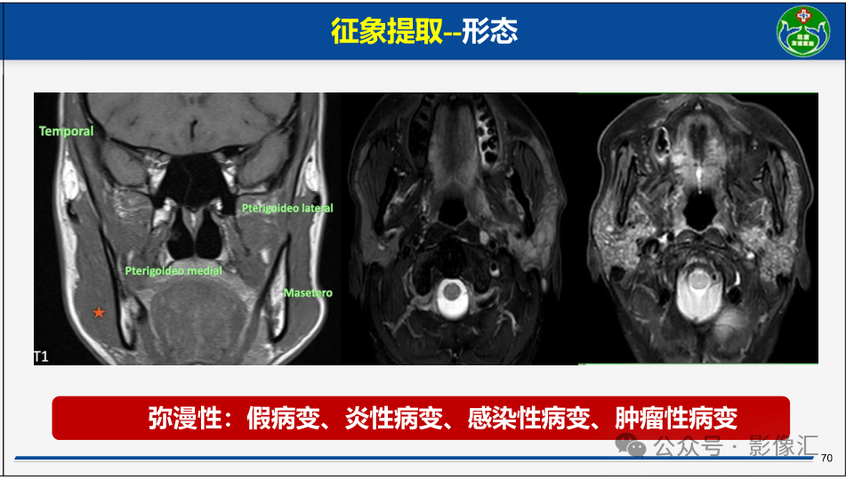 ece804d9e70a3d78dfa2894bbc12b83b.png