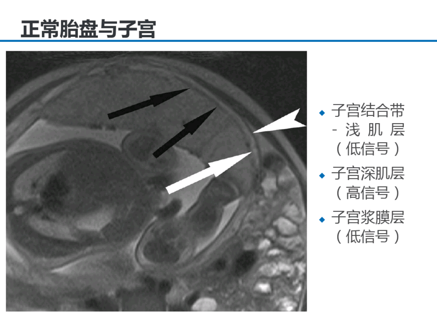 333ca7e345be4f9b51915e3da18c3eb4.png