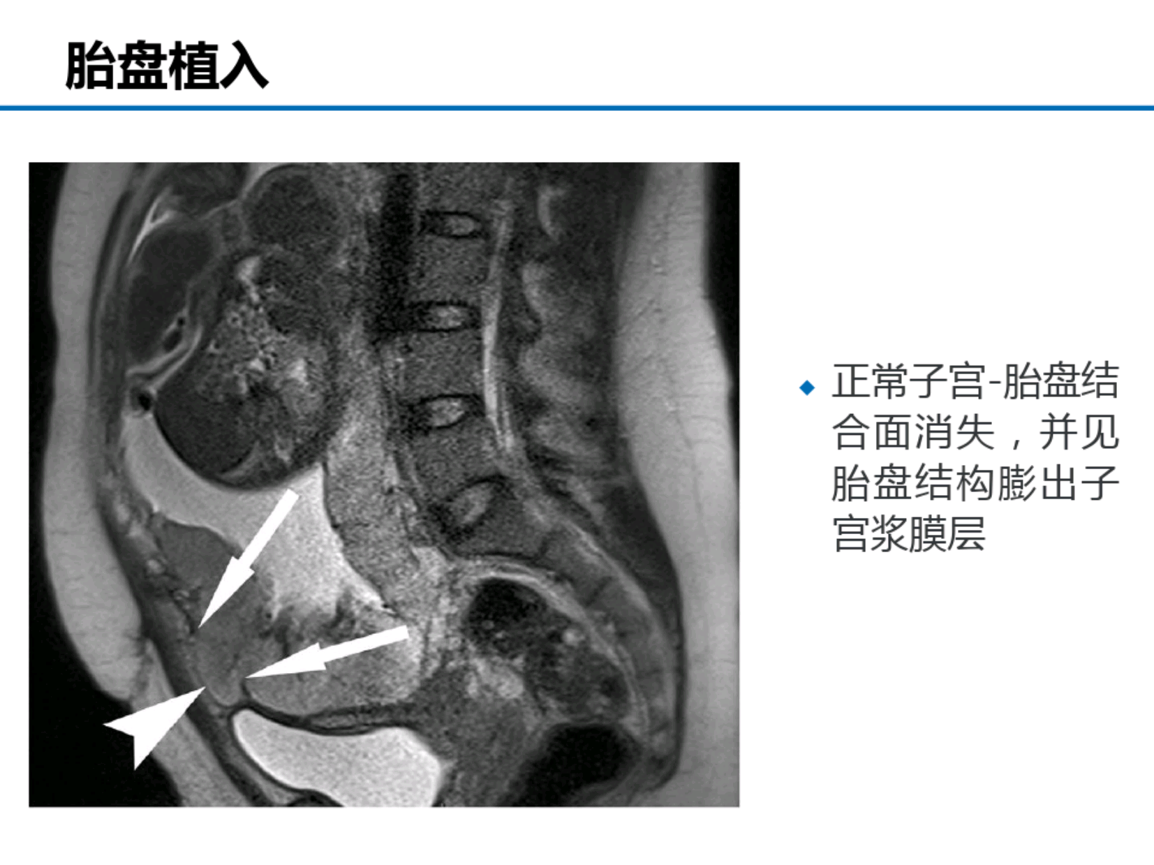 b541c81844f67259d46da34139a3f885.png