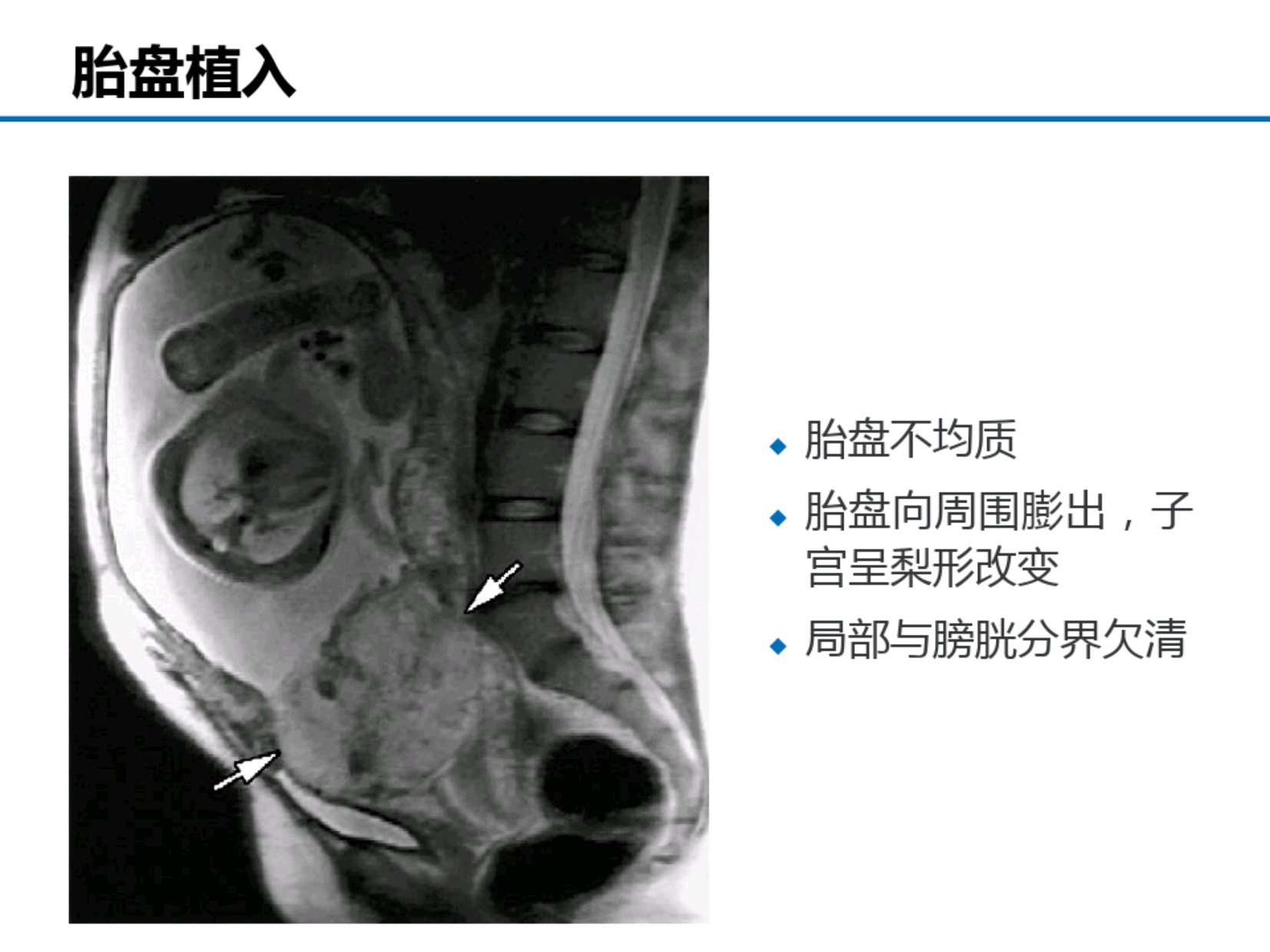 abc0637f59225820411619a400a241c6.png
