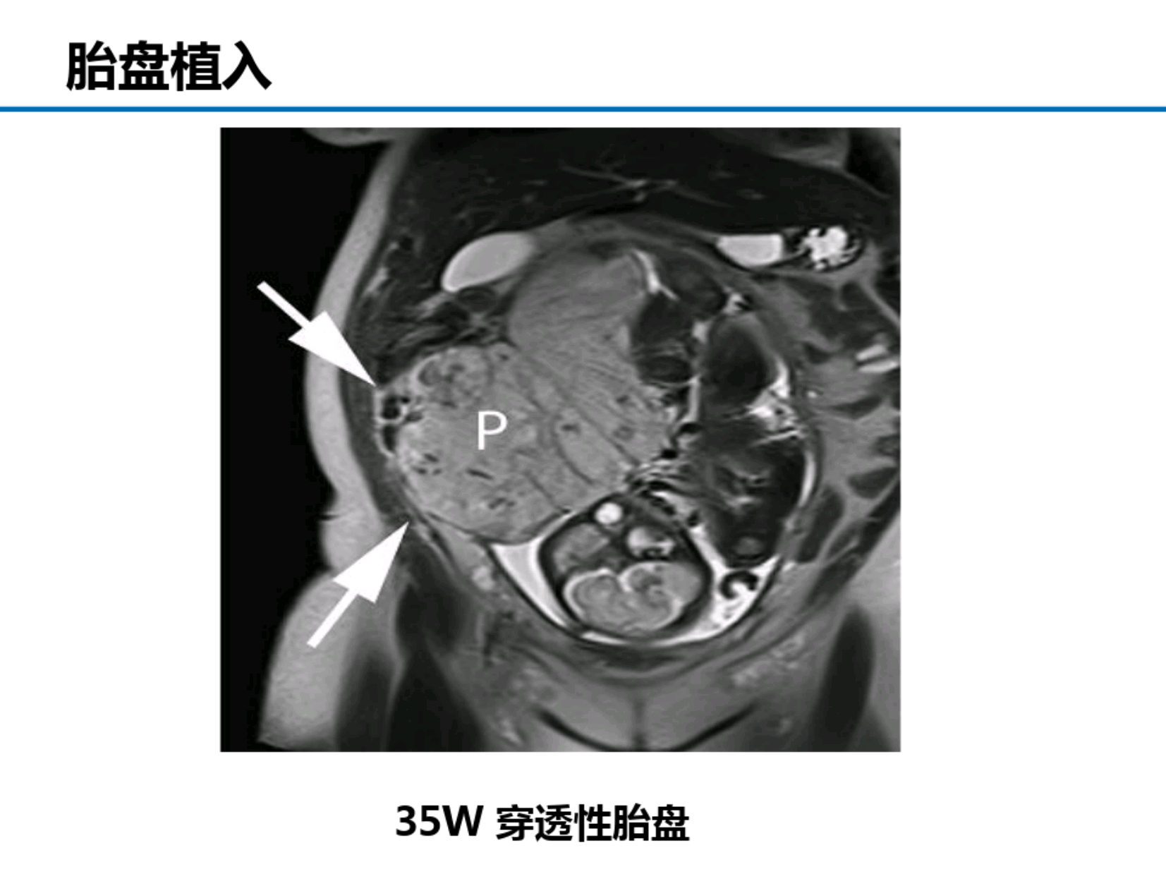 af644cd9bdac9ef6a0f0d0926cde220c.png