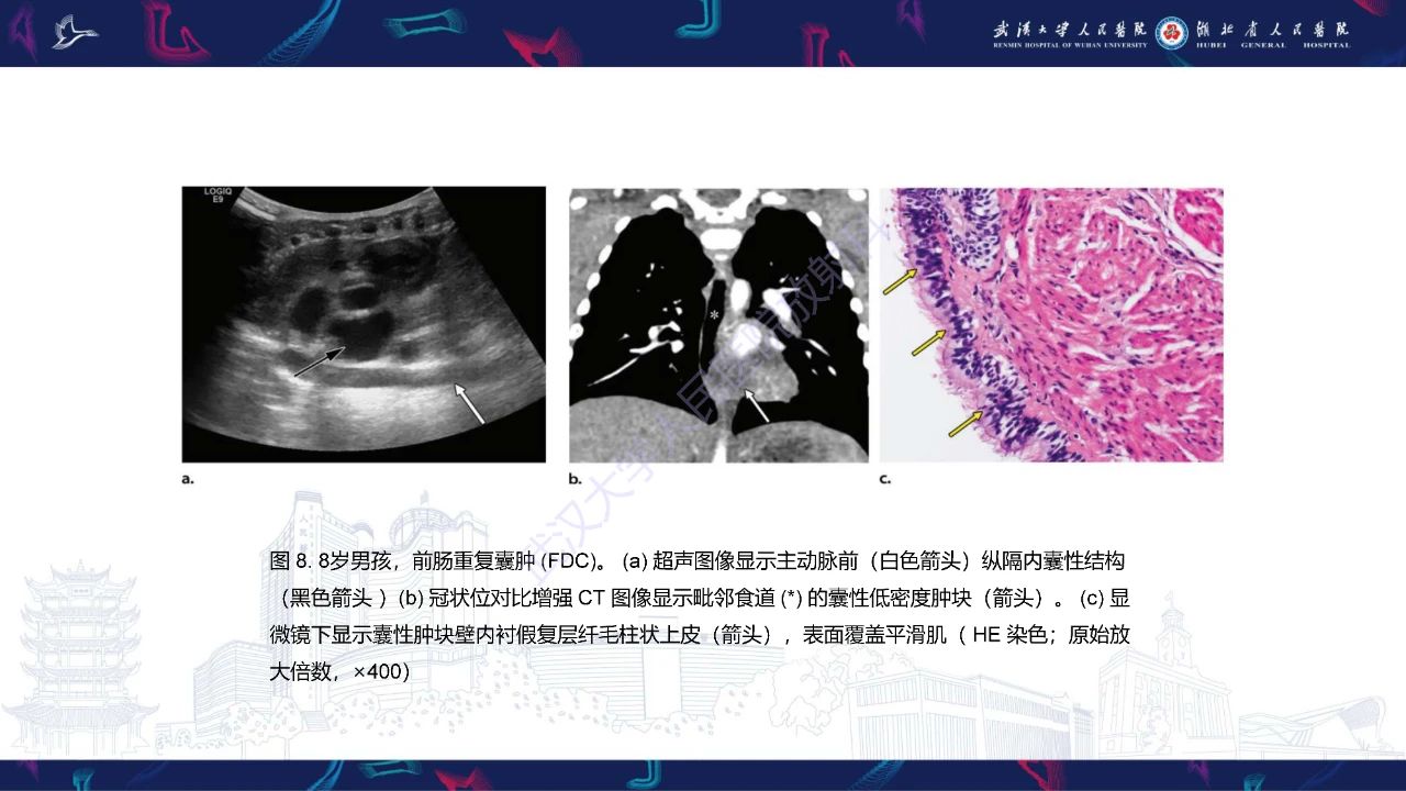 a29888bb4a054a360dea8fffaf139805.jpg