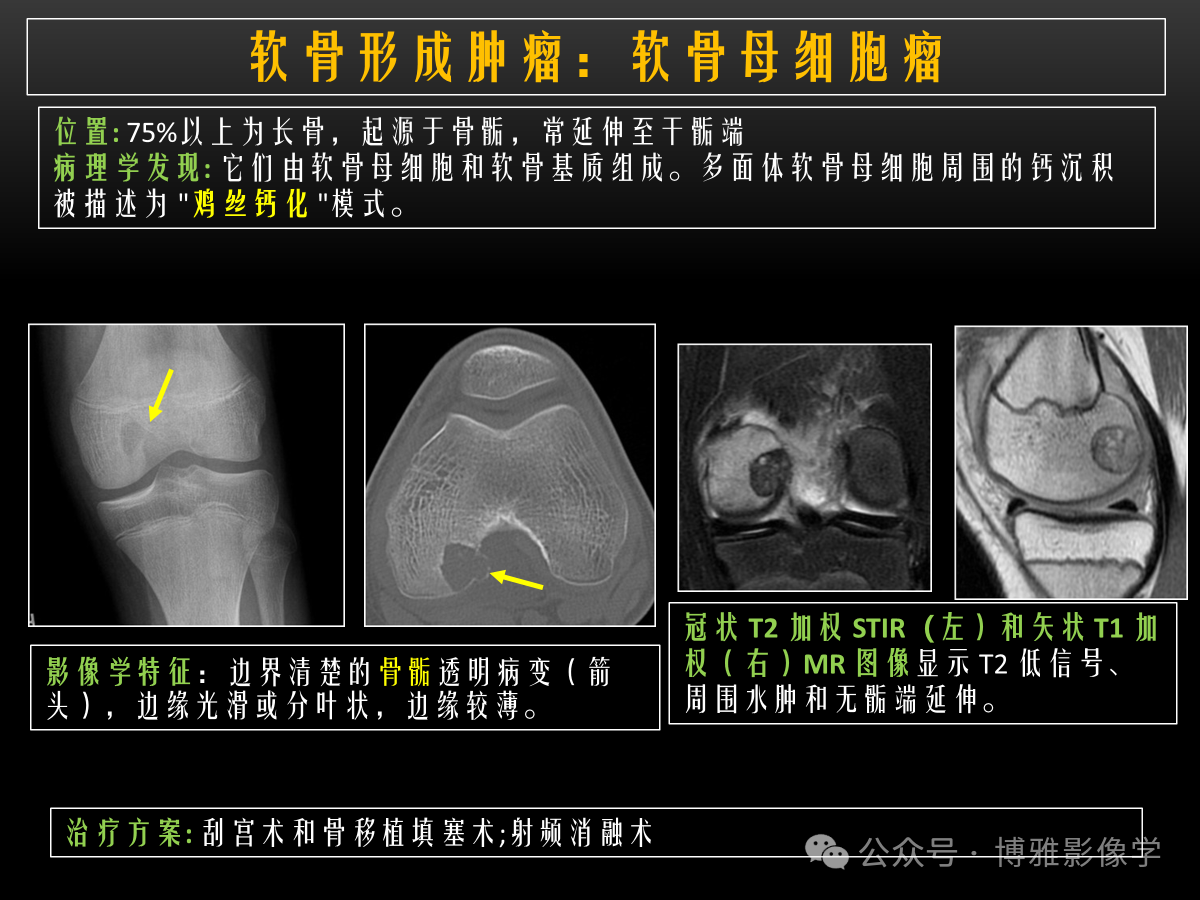 34d103bf12c483ed1d75cd78f7a5b5e8.png