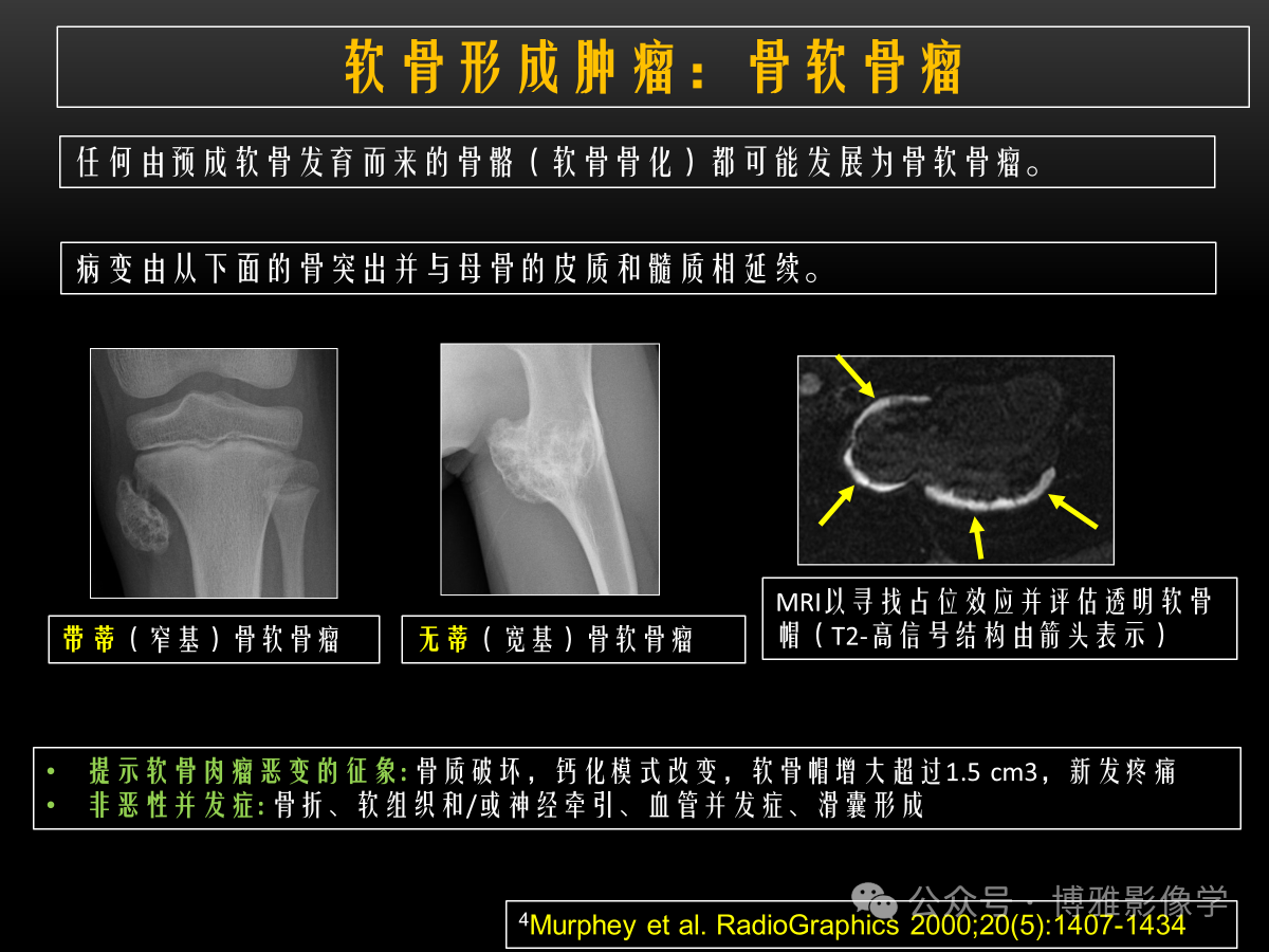 54f754c9cb206276d13f65e94754ed69.png