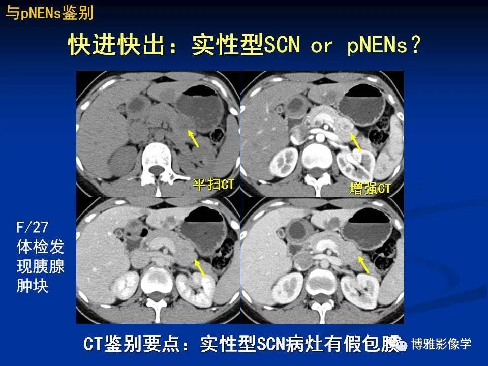 90e525defa0099e2936c2fa0ccaa758c.jpg