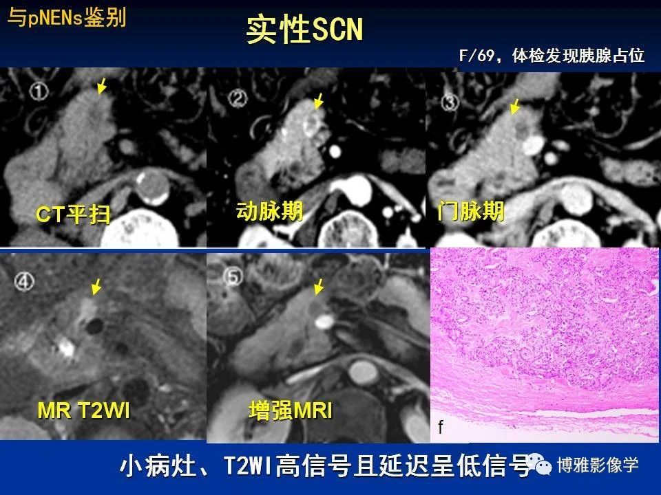 a114e2d396b810e21727cb8810a3c354.jpg