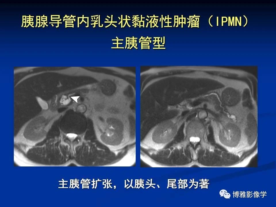 52b17aec9b5e11adc04d1206b25c8810.jpg