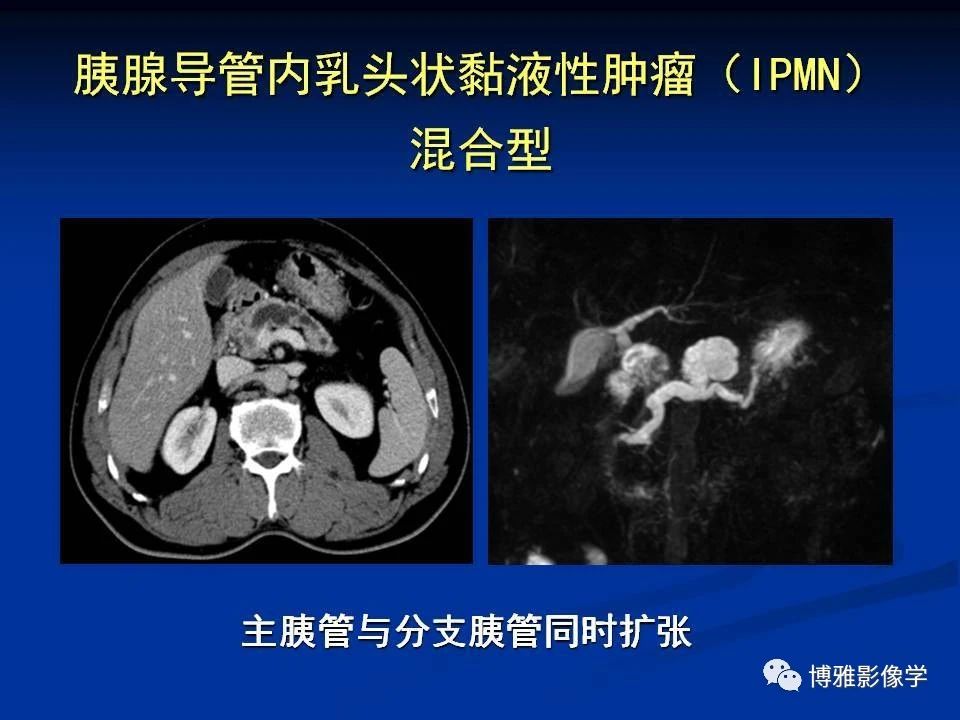 b17d79cd7f3cfa3966a36dca42aed9f1.jpg