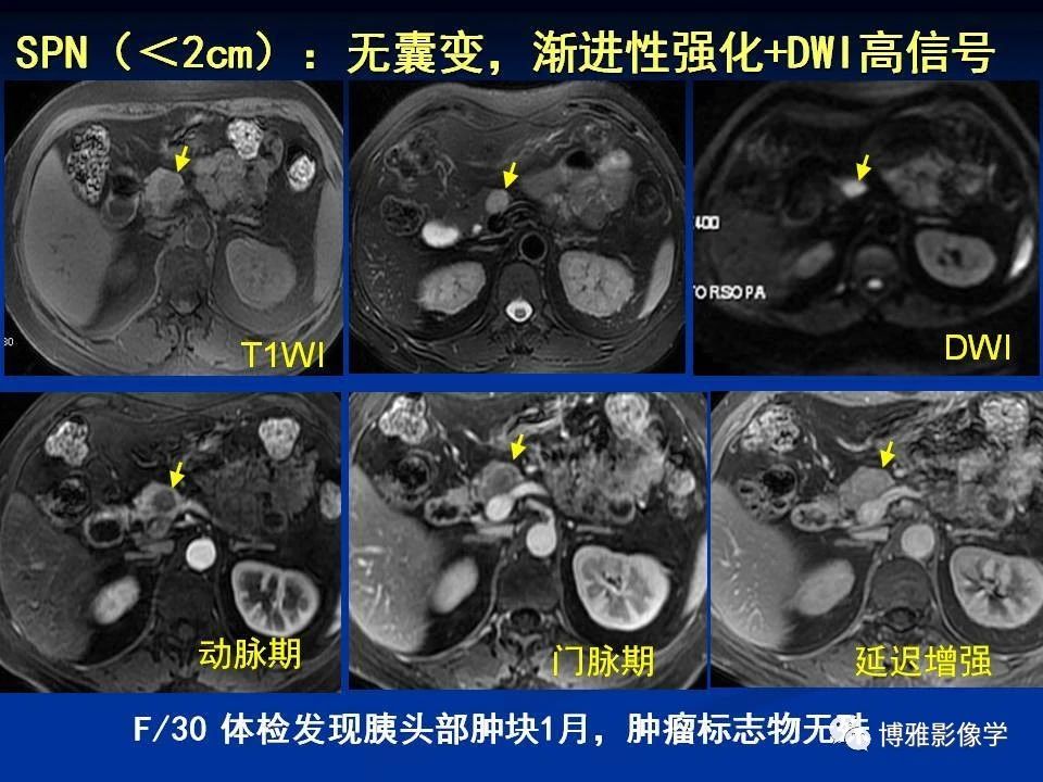 ffcd6f04192034844f13e2e93db6dade.jpg