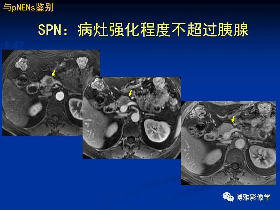 7537c2b66a910d88b2dd9b7349c9852a.jpg