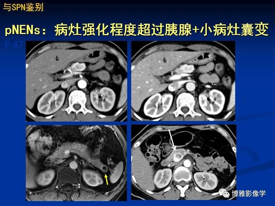 1ce725bbae55cc288dc090530c94862d.jpg
