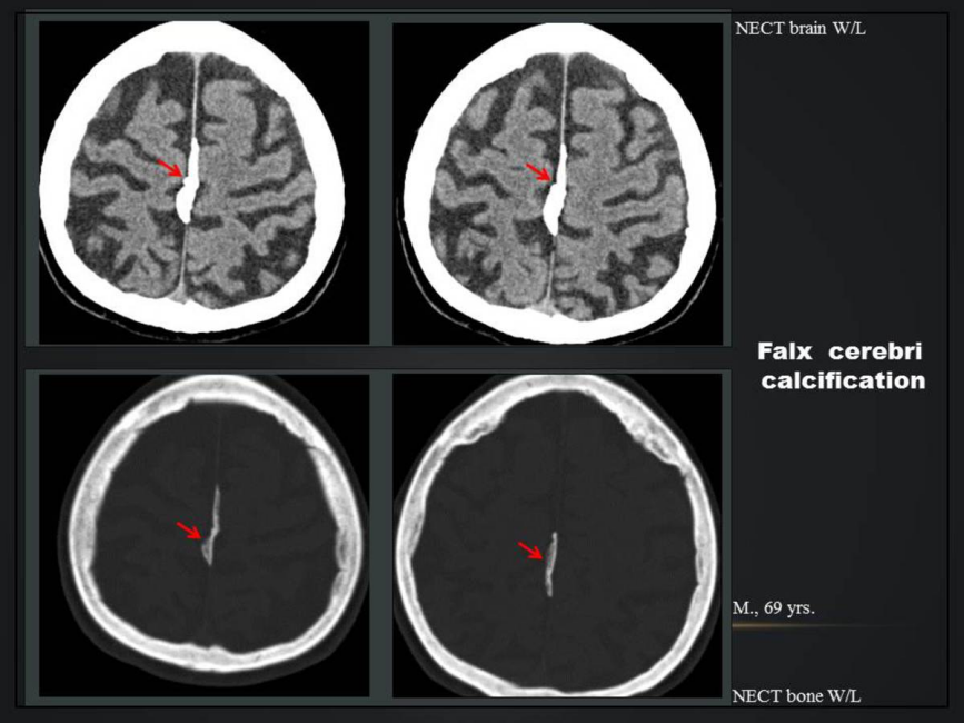 a12204672afd49e05f8a2dfb499d1f95.png