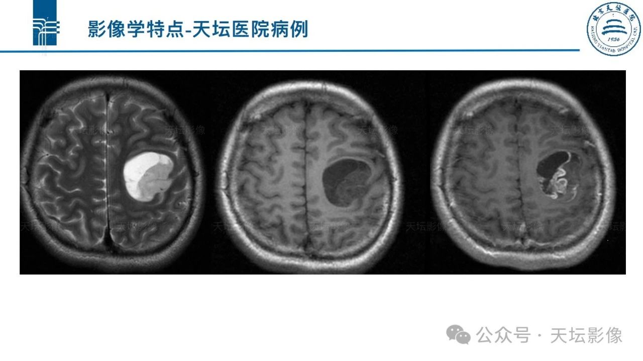 ad00563da82a6cd59bd9b37e75ce5647.jpg