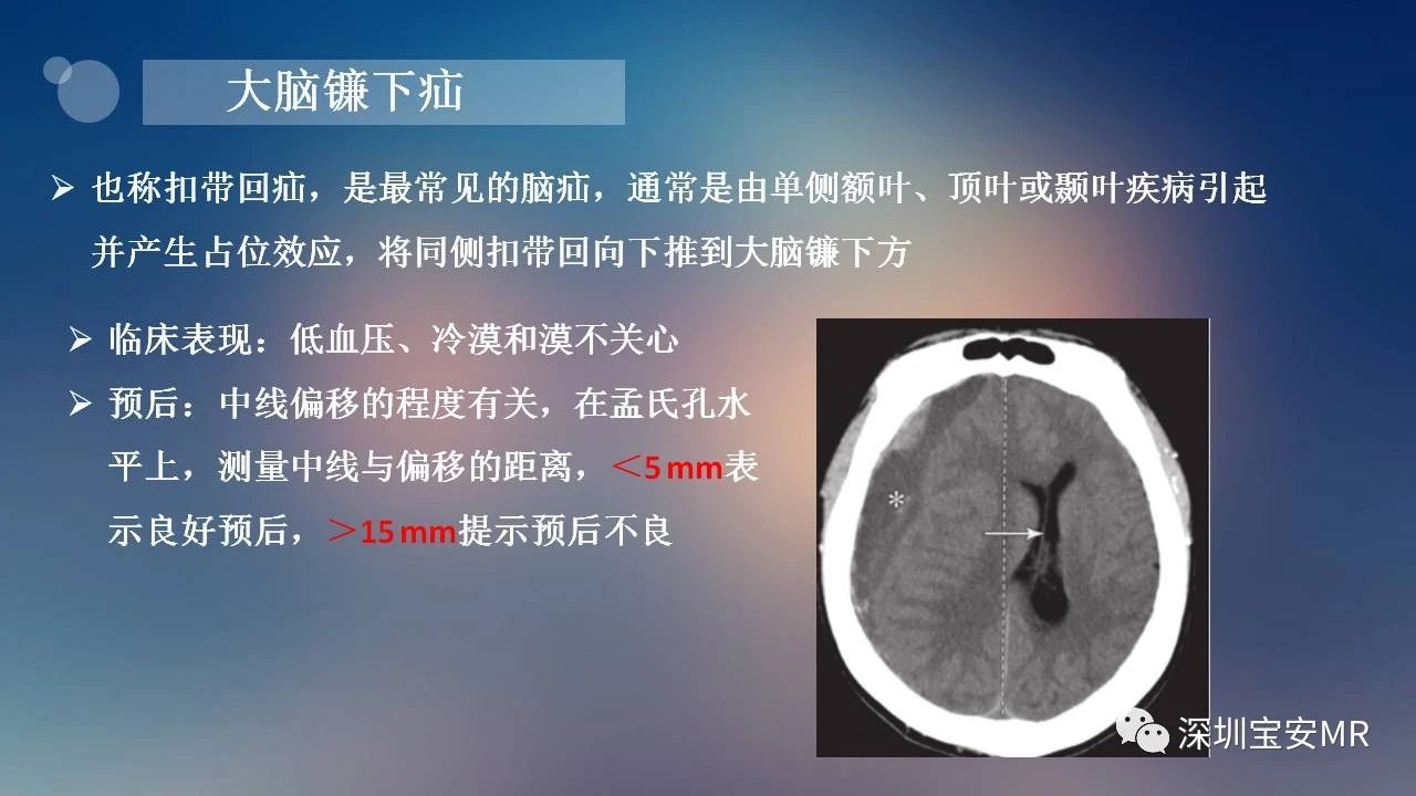 5106d3a127ace2d9bbe79560ccdb14eb.jpg